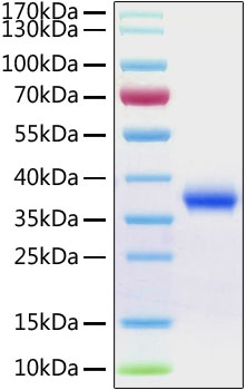 Recombinant SARS-CoV-2 Spike RBD  Protein