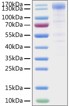 Recombinant SARS-CoV-2 Spike S1 Protein