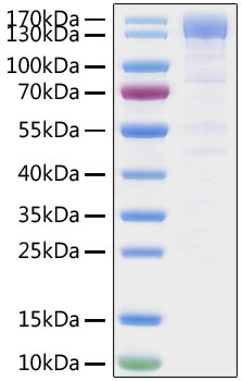 Recombinant SARS-CoV-2 Spike S1 Protein