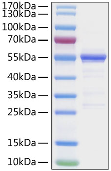 Recombinant SARS-CoV-2 Nucleocapsid(G335A) Protein