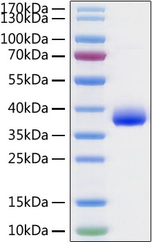 Recombinant SARS-CoV-2 Spike RBD  Protein