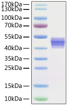 Recombinant Human IL-12B/IL-12 p40 Protein