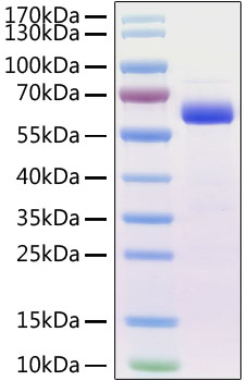 Recombinant Mouse Siglec-15/CD33L3 Protein