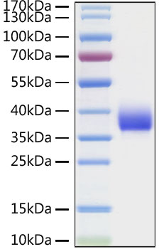 Recombinant SARS-CoV Spike RBD  Protein