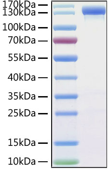 Recombinant MERS-CoV Spike S1 Protein