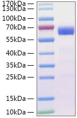 Recombinant SARS-CoV Spike RBD  Protein