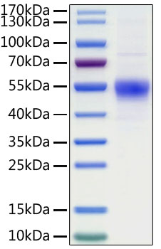 Recombinant Human CD19 Protein