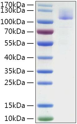 Recombinant SARS-CoV Spike S1 Protein