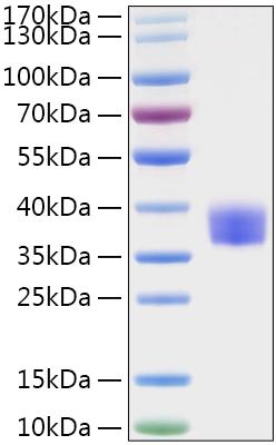 Recombinant MERS-CoV Spike RBD  Protein