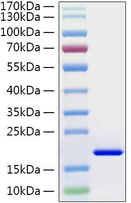 Recombinant Human IL-21 Protein