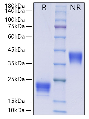 Recombinant Human IL-5 Protein