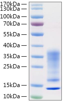 Recombinant Human IL-13 Protein