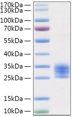 Recombinant Mouse IL-6 Protein