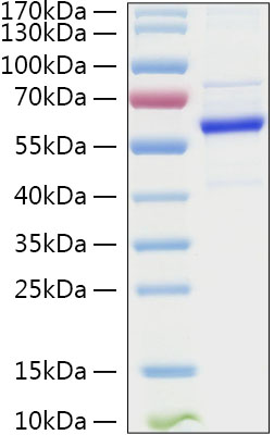 Recombinant Human TET2 Protein