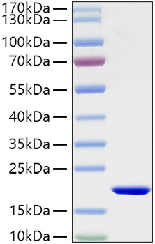 Recombinant Mouse IL-1 beta Protein