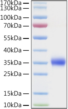 Recombinant Human TIMP-1 Protein