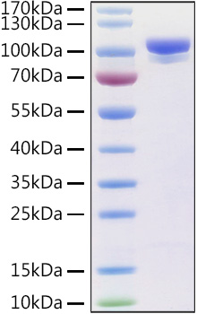 Recombinant Human Prolyl endopeptidase FAP Protein