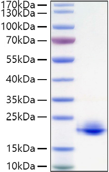 Recombinant Human Myelin oligodendrocyte glycoprotein/MOFG Protein