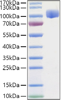 Recombinant Human ROBO4 Protein