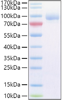 Recombinant Human Vasorin/SLITL2/VASN Protein