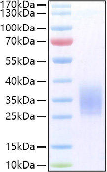 Recombinant Human PTH1R Protein