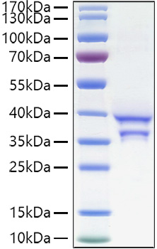 Recombinant Human CCL17/TARC Protein