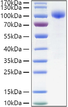 Recombinant Human IL-23R Protein