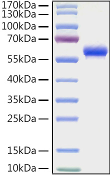 Recombinant Human Fc gamma RIIA/FCGR2A/CD32a (H167R) Protein