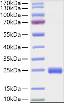 Recombinant Mouse IL-2 Protein