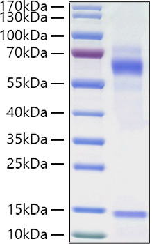 Recombinant Human Vitronectin/V75/VTN Protein