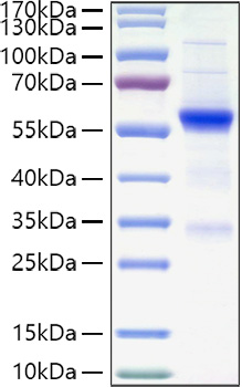 Recombinant Human TET2 Protein