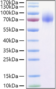 Recombinant Human Osteoactivin/GPNMB Protein