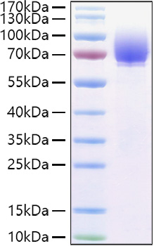 Recombinant Human Microtubule-associated protein tau/MAPT Protein