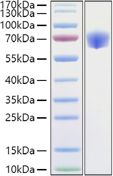 Recombinant Mouse TNFRSF1B/TNF-R2/CD120b Protein