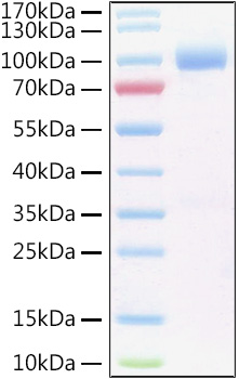 Recombinant Human IL-6RA/CD126 Protein