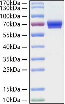 Recombinant Human IL-2RA/CD25 Protein