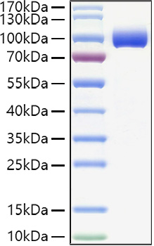 Recombinant Human PIgR Protein