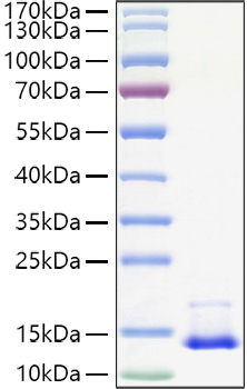 Recombinant Human CCL2/MCP-1 Protein