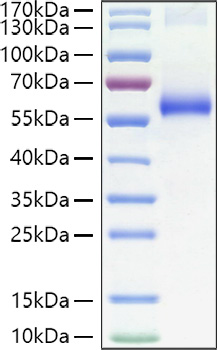 Recombinant Human TNFRSF1A/TNF-R1/CD120a Protein