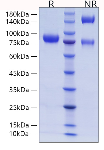 Recombinant Human Endoglin/ENG/CD105 Protein