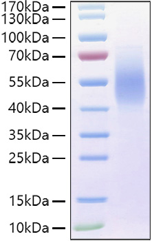 Recombinant Human MUC-16/CA125 Protein