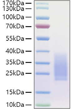 Recombinant Human BMPR-2 Protein