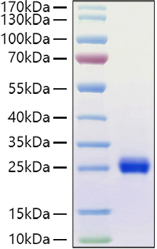 Recombinant Human Ephrin-A1/EFNA1 Protein