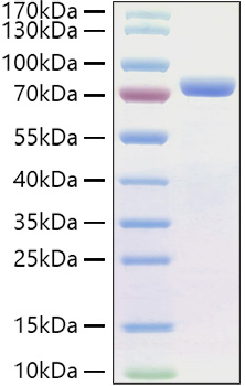 Recombinant Human E-Cadherin/CDH1/CD324 Protein