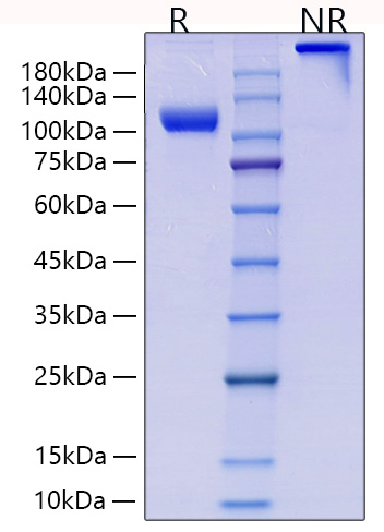 Recombinant Human Endoglin/ENG/CD105 Protein