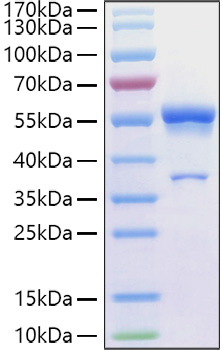 Recombinant Human Ephrin-A1/EFNA1 Protein