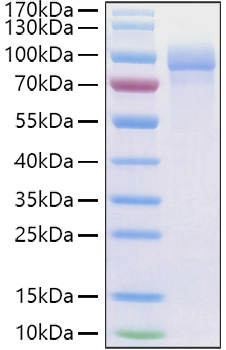 Recombinant Human Fibronectin/CIG/FN1 Protein