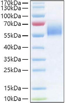 Recombinant Human IL-36R/IL-1Rrp2/IL1RL2 Protein