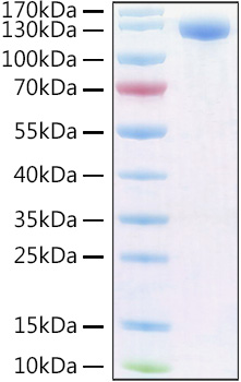 Recombinant Human PIgR Protein