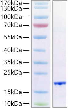 Recombinant Human FGF-6 Protein